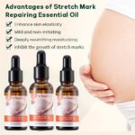 Kormesic Stretch Mark Repair Oil