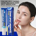 Dark Spot Removal Cream - Image 2