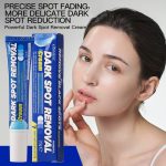 Dark Spot Removal Cream